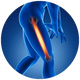 Knie